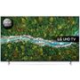 LG 75UP77006LB
